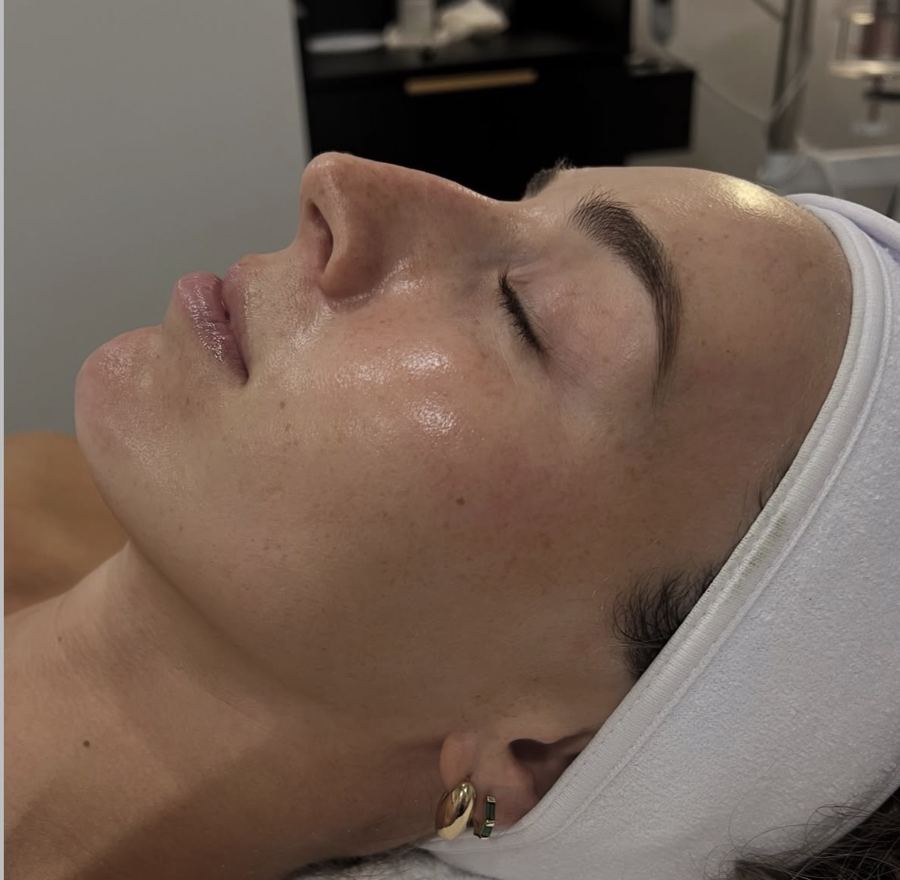 Glowing skin after a Hydrafacial at Ra'pôr Salon in Costa Mesa